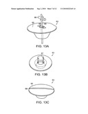 Bladder diagram and image