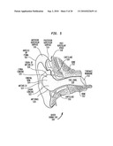 HEARING DEVICE HAVING A NON-OCCLUDING IN THE CANAL VIBRATING COMPONENT diagram and image