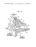 HEARING DEVICE HAVING A NON-OCCLUDING IN THE CANAL VIBRATING COMPONENT diagram and image