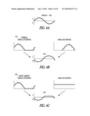 BIAS-PROBE ROTATION TEST OF VESTIBULAR FUNCTION diagram and image