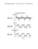 BIAS-PROBE ROTATION TEST OF VESTIBULAR FUNCTION diagram and image