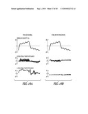 BIAS-PROBE ROTATION TEST OF VESTIBULAR FUNCTION diagram and image