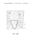 Synchronization of Repetitive Therapeutic Interventions diagram and image