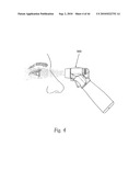 OPHTHALMIC FLUID DELIVERY SYSTEM diagram and image