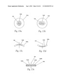 OPHTHALMIC FLUID DELIVERY SYSTEM diagram and image