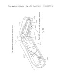 OPHTHALMIC FLUID DELIVERY SYSTEM diagram and image