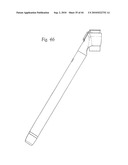 OPHTHALMIC FLUID DELIVERY SYSTEM diagram and image