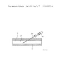 INTERVENTIONAL MEDICAL CLOSURE DEVICE diagram and image