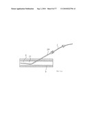 INTERVENTIONAL MEDICAL CLOSURE DEVICE diagram and image