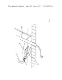 INTERVENTIONAL MEDICAL CLOSURE DEVICE diagram and image