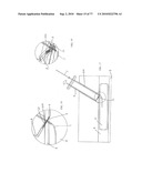 INTERVENTIONAL MEDICAL CLOSURE DEVICE diagram and image