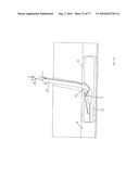 INTERVENTIONAL MEDICAL CLOSURE DEVICE diagram and image