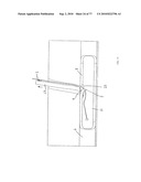 INTERVENTIONAL MEDICAL CLOSURE DEVICE diagram and image