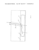 INTERVENTIONAL MEDICAL CLOSURE DEVICE diagram and image