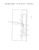 INTERVENTIONAL MEDICAL CLOSURE DEVICE diagram and image