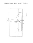 INTERVENTIONAL MEDICAL CLOSURE DEVICE diagram and image