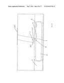 INTERVENTIONAL MEDICAL CLOSURE DEVICE diagram and image