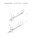 INTERVENTIONAL MEDICAL CLOSURE DEVICE diagram and image