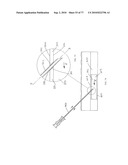 INTERVENTIONAL MEDICAL CLOSURE DEVICE diagram and image