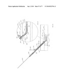 INTERVENTIONAL MEDICAL CLOSURE DEVICE diagram and image