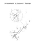 INTERVENTIONAL MEDICAL CLOSURE DEVICE diagram and image