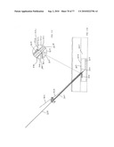 INTERVENTIONAL MEDICAL CLOSURE DEVICE diagram and image