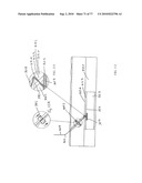 INTERVENTIONAL MEDICAL CLOSURE DEVICE diagram and image