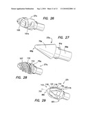 Bladeless Obturator diagram and image