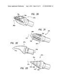 Bladeless Obturator diagram and image