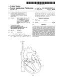 Cardiac Rhythm Management System with Arrhythmia Classification and Electrode Selection diagram and image