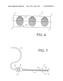 DUAL-PURPOSE LASSO CATHETER WITH IRRIGATION USING CIRCUMFERENTIALLY ARRANGED RING BUMP ELECTRODES diagram and image