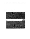 DRUG DELIVERY FROM STENTS diagram and image