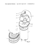 VACUUM CLEANER WITH A REMOVABLE CYCLONE ARRAY diagram and image