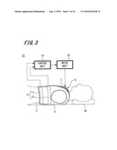 AIRWAY-OPENING DEVICE diagram and image