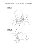 AIRWAY-OPENING DEVICE diagram and image