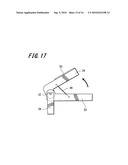 AIRWAY-OPENING DEVICE diagram and image