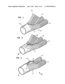 Surgical Stapling System diagram and image