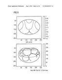 MULTI-CHANNEL METHOD AND DEVICE TO EVALUATE MAGNETIC RESONANCE SIGNALS, WITH REDUCED NUMBER OF CHANNELS diagram and image