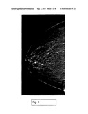 MAMMOGRAPHY/TOMOSYNTHESIS SYSTEMS AND METHODS AUTOMATICALLY DERIVING BREAST CHARACTERISTICS FROM BREAST X-RAY IMAGES AND AUTOMATICALLY ADJUSTING IMAGE PROCESSING PARAMETERS ACCORDINGLY diagram and image