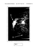 MAMMOGRAPHY/TOMOSYNTHESIS SYSTEMS AND METHODS AUTOMATICALLY DERIVING BREAST CHARACTERISTICS FROM BREAST X-RAY IMAGES AND AUTOMATICALLY ADJUSTING IMAGE PROCESSING PARAMETERS ACCORDINGLY diagram and image