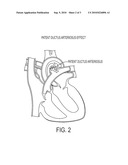 METHOD FOR INTRATHECAL ADMINISTRATION OF AUTOLOGOUS STEM CELLS IN PREMATURE INFANTS diagram and image