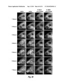 HERPES SIMPLEX VIRUS MUTANT ICP0 diagram and image