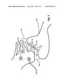 TRANSDERMAL PAIN GEL diagram and image