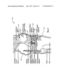 TRANSDERMAL PAIN GEL diagram and image