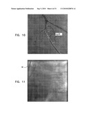 CONTROLLED ACTUATION AND DEPLOYMENT OF A MEDICAL DEVICE diagram and image