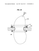 METHODS AND DEVICES FOR PROVIDING ACCESS INTO A BODY CAVITY diagram and image