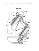 METHODS AND DEVICES FOR PROVIDING ACCESS INTO A BODY CAVITY diagram and image