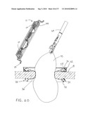 SURGICAL ACCESS DEVICES AND METHODS PROVIDING SEAL MOVEMENT IN PREDEFINED MOVEMENT REGIONS diagram and image