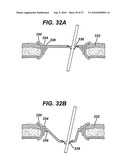 SURGICAL ACCESS DEVICES AND METHODS PROVIDING SEAL MOVEMENT IN PREDEFINED MOVEMENT REGIONS diagram and image