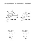 SURGICAL ACCESS DEVICES AND METHODS PROVIDING SEAL MOVEMENT IN PREDEFINED MOVEMENT REGIONS diagram and image